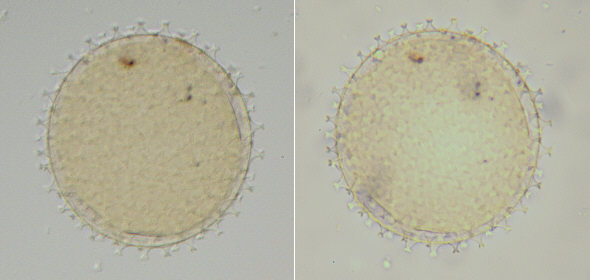 [ Vergleichsaufnahmen mit 10er Objektiven ]